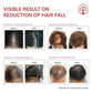 Ivory Natural Hair Fall Serum For Hair Fall & Soothes Scalp, For Men & Women | Swadesiicart