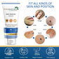 7 Days Natural Wart Remover Cream with AHA- BHA - Swadesiicart