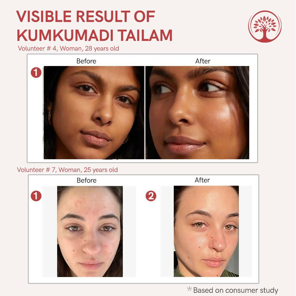 Ivory Natural Kumkumadi Tailam Face Oil - Saffron And Lotus Essence For Skin Revitalization | Swadesiicart