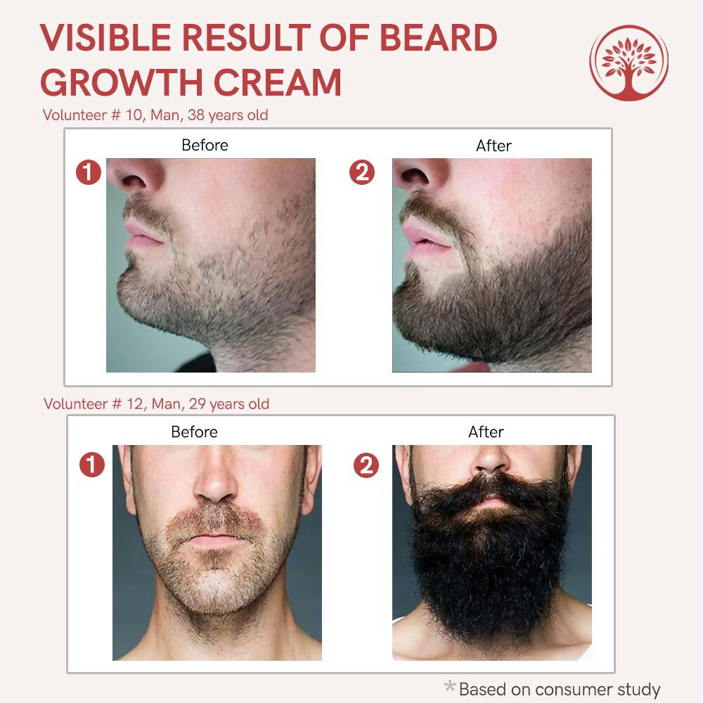 Ivory Natural Beard Growth Cream - Biotin Boosted Hair Follicle For New Hair Cycle | Swadesiicart
