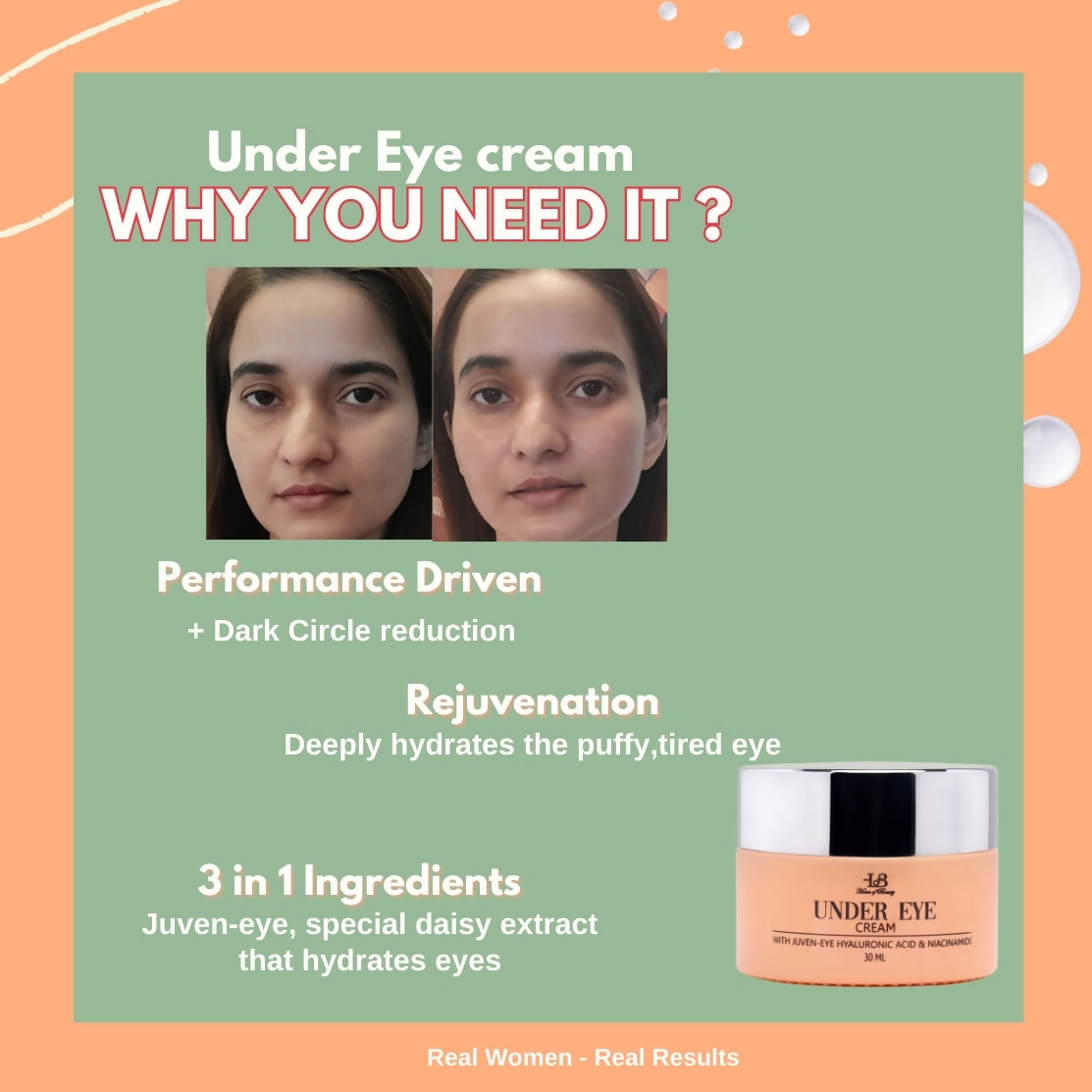 House of Beauty Under Eye Cream - Swadesiicart
