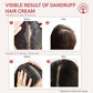 Ivory Natural Dandruff Hair Cream For Dandruff, And Nourishing Dry Scalp | Swadesiicart