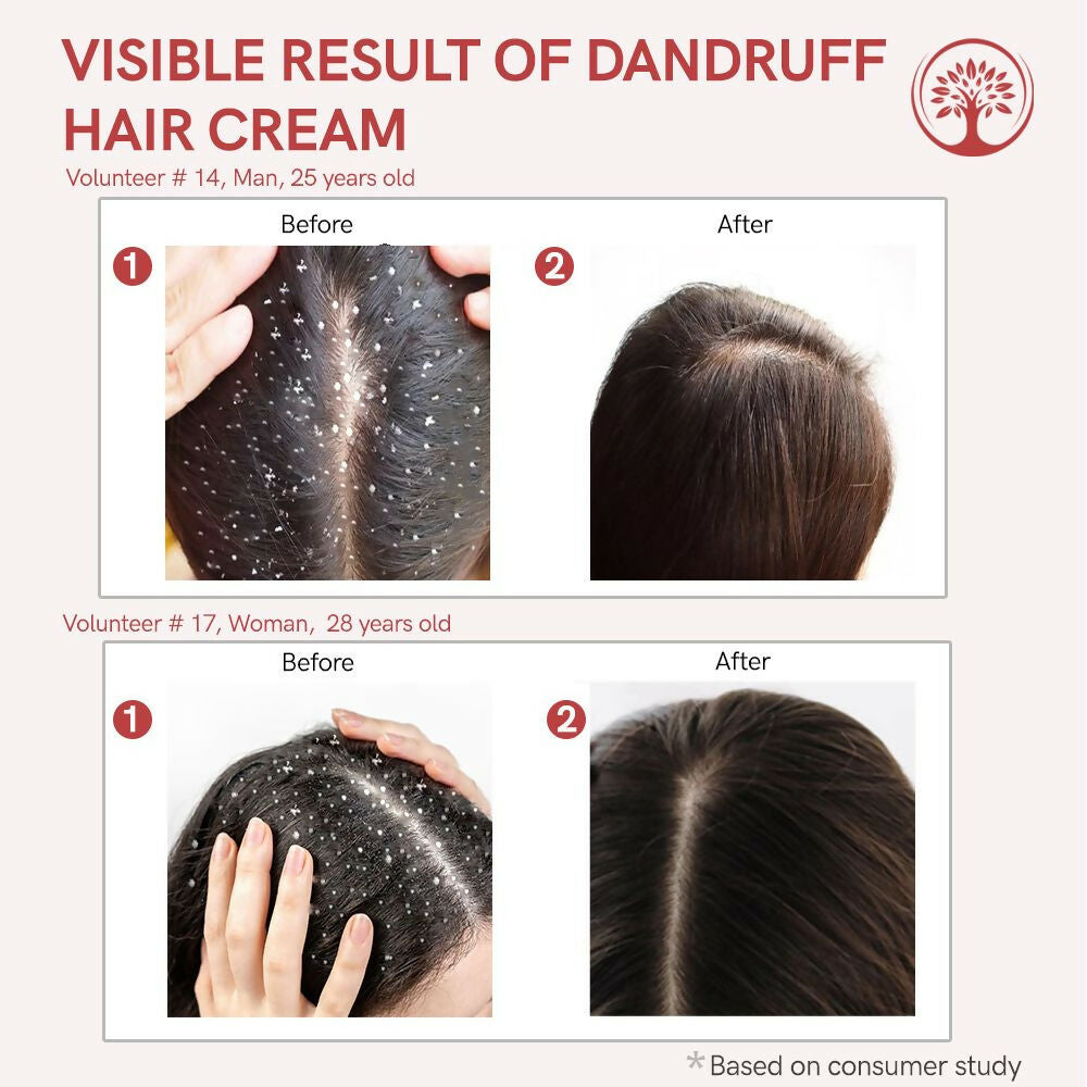 Ivory Natural Dandruff Hair Cream For Dandruff, And Nourishing Dry Scalp | Swadesiicart