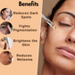 Dermistry Skin Perfecting Fairness Face Serum Resorcinol Kojic Acid Hyper Pigmentation Uneven Tone - Swadesiicart