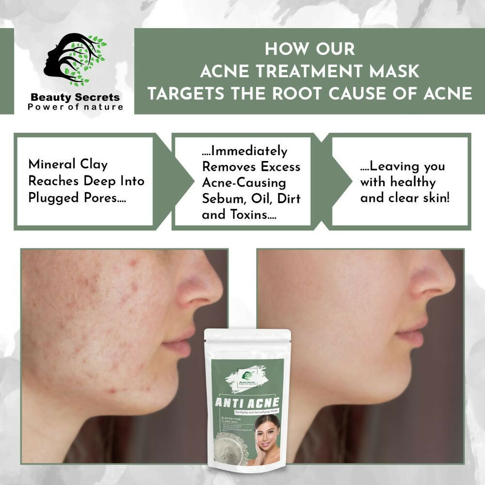 Beauty Secrets Anti Acne Face Mask - Swadesiicart