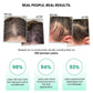 ThriveCo Rosemary Water Hair Spray For Hair Growth - Swadesiicart