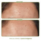 The Skin Diet Company Matcha Green Tea Toner Hydrates, Clarifies Pores, Alcohol-Free, For Oily Skin | Swadesiicart