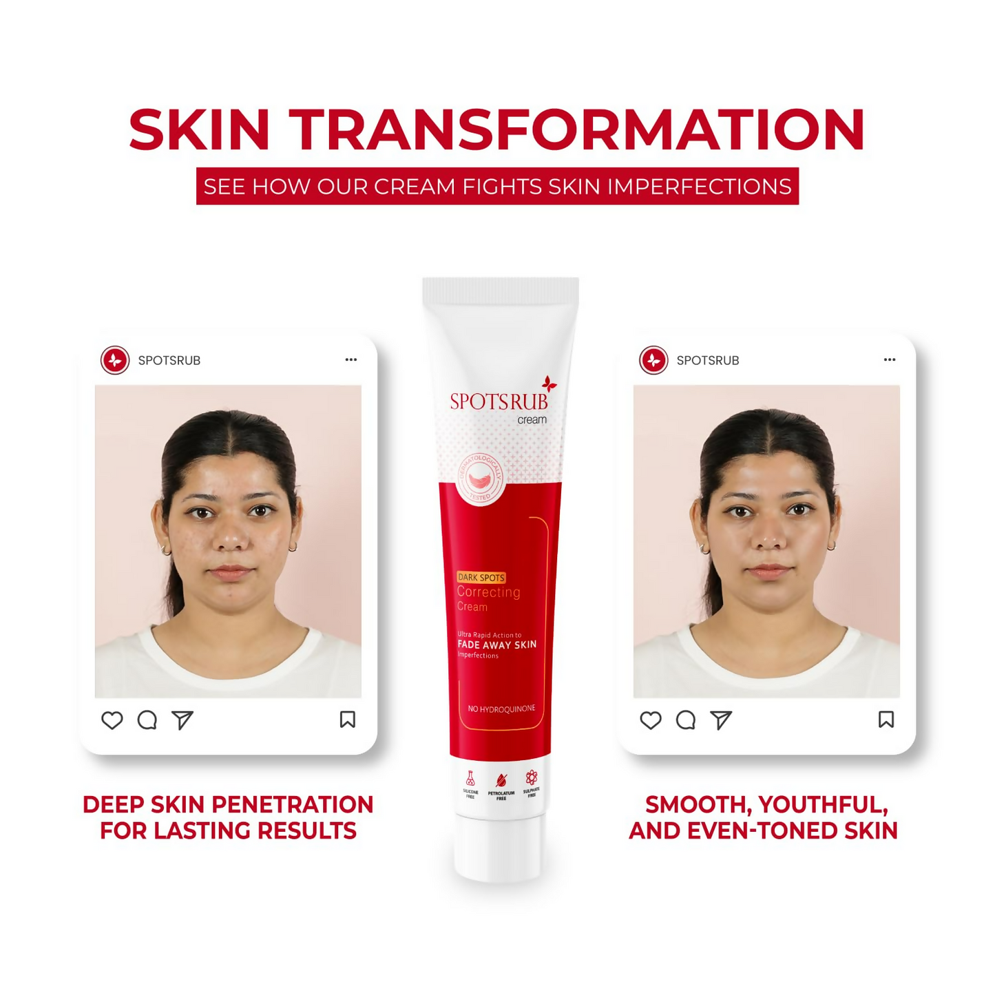Leeford Spotsrub Face Cream For Women | Swadesiicart