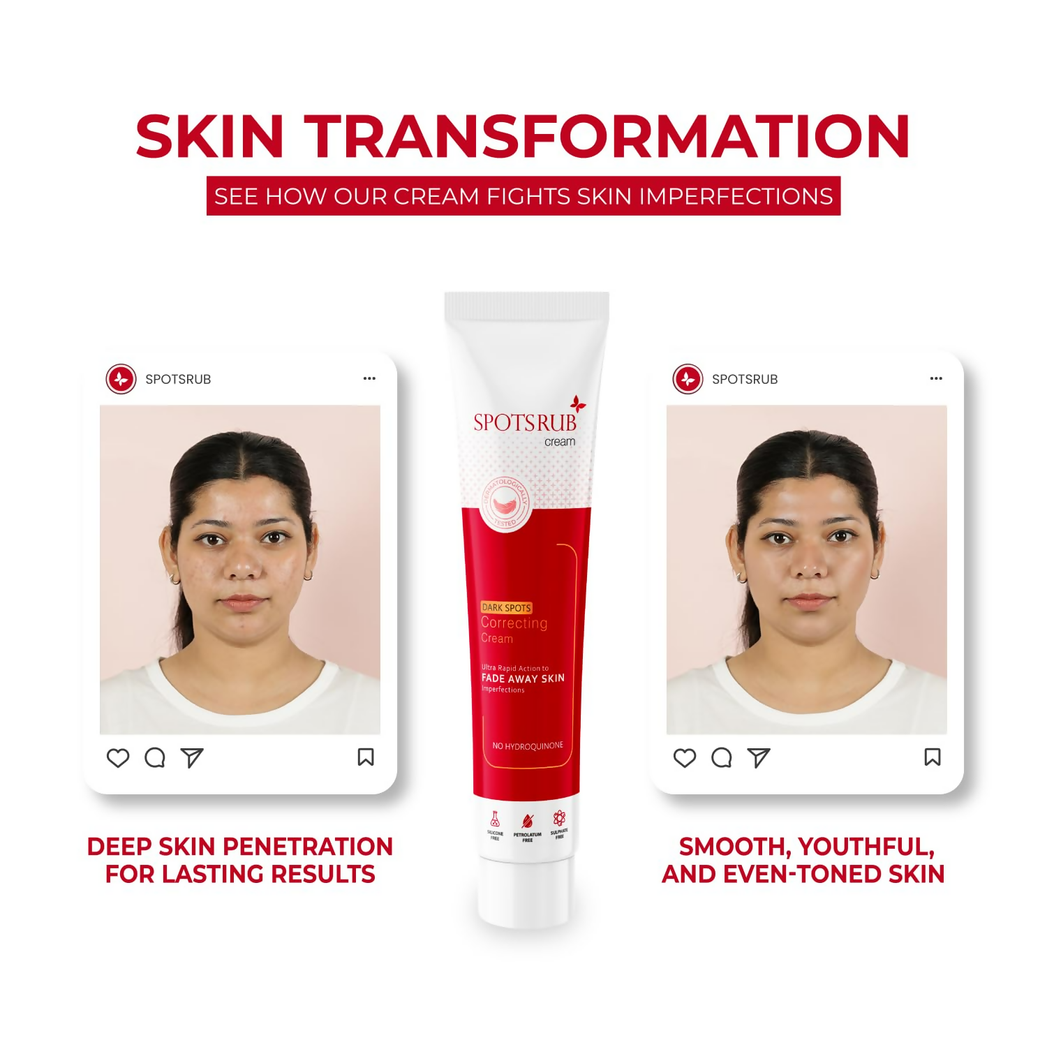 Leeford Spotsrub Face Cream For Women | Swadesiicart